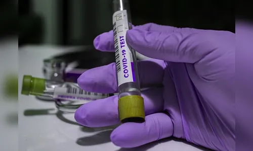 Arapongas confirma mais 117 casos de Covi-19 e 2 mortes