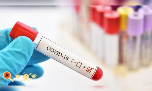 Arapongas registra 81 novos casos de covid nesta quinta