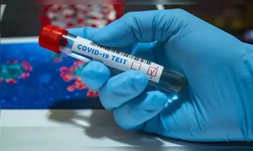 Londrina confirma nova morte por Covid-19 e mais 187 casos