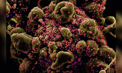 Mais dois idosos morrem por Covid-19 em Apucarana