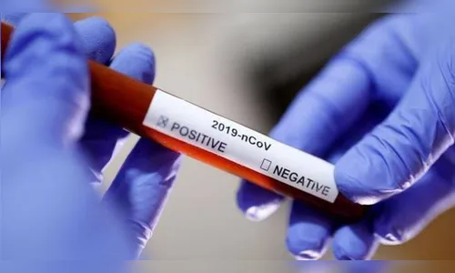 Arapongas confirma 111 novos casos de Covid-19