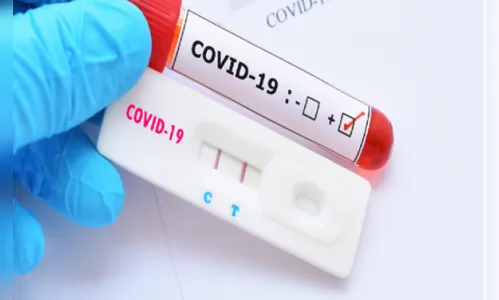 Paraná confirma mais 129 óbitos pela Covid-19