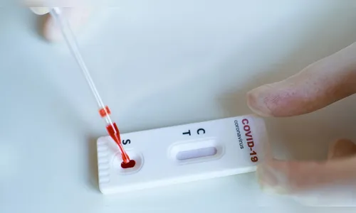 Londrina confirma mais 251 casos de Covid-19 e uma morte