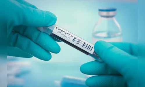 Paraná registra 3.998 novos casos da Covid-19