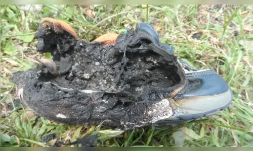 Vítima de violência doméstica tem um braço e tênis queimados