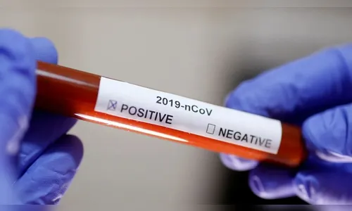 São João do Ivaí confirma mais quatro casos de coronavírus