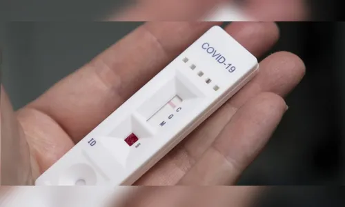 Testes na rede privada só devem ser feitos 72 horas após sintomas