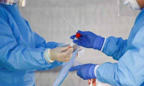 São João do Ivaí confirma mais seis casos de coronavírus