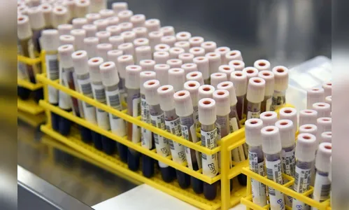 Nota da Saúde do Paraná esclarece diferenças entre dengue e Covid