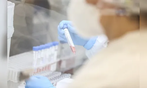 Apucarana soma mais um óbito e passa dos 5 mil casos de covid