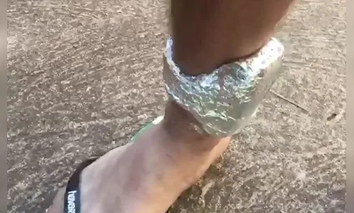 Suspeito cobre tornozeleira com alumínio para despistar localização