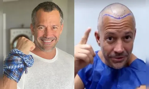 'Contra a calvície', Malvino Salvador dá a receita