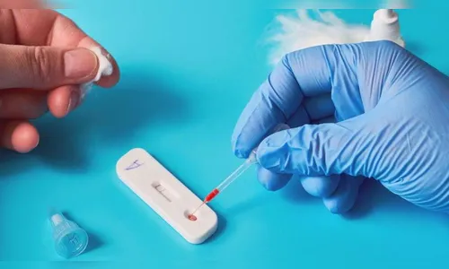 Covid-19 já infectou mais de 597 mil paranaenses