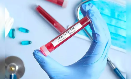 Ivaiporã tem mais cinco casos confirmados de covid-19, nesta sexta (05/02)