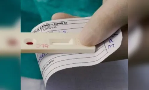 Ivaiporã tem mais 10 casos confirmados de coronavírus, nesta terça-feira (09/02)