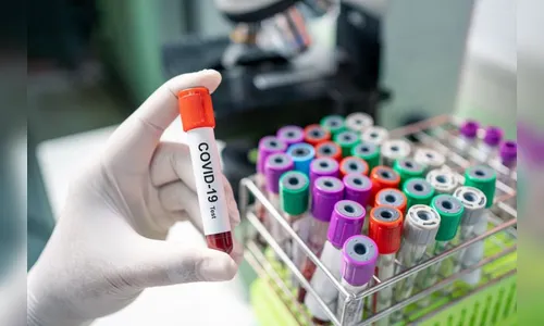 Mais quatro diagnósticos positivos da Covid-19 em Jardim Alegre