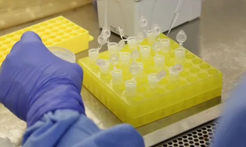 Mais três casos de Covid-19 em Jardim Alegre, nesta segunda (25)