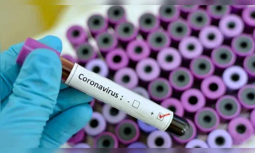 Covid-19: Ivaiporã tem 11 casos positivos nesta segunda (01/02)