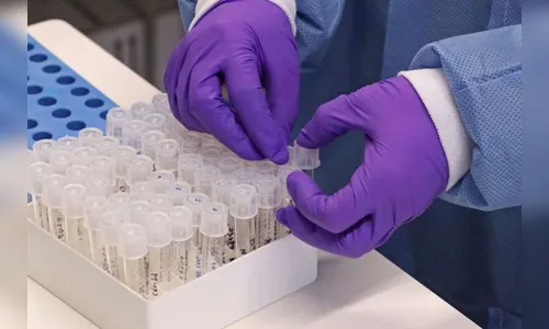 Ivaiporã tem 12 casos positivos de Covid-19 nesta quarta (10/02)