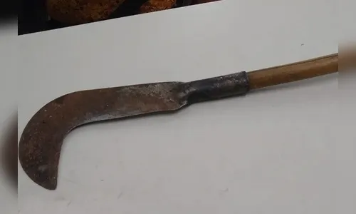 Bebê de 7 meses é atingido com golpe  de foice