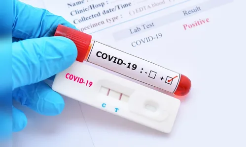 Jandaia do Sul confirma mais 8 casos de Covid-19