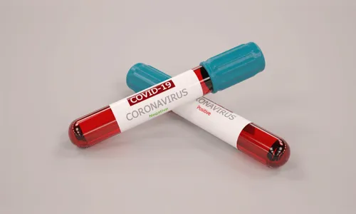 Londrina confirma mais 5 mortes por Covid-19 e mais 147 casos