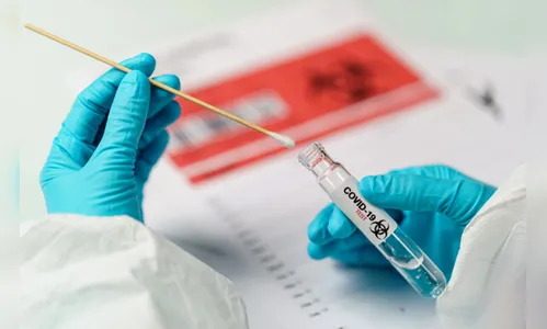 Maringá registra 4 óbitos e 103 novos casos de Covid-19