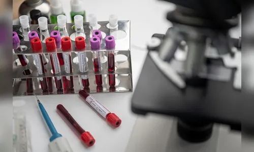 Mortes por covid-19 no Brasil passam da marca de 240 mil