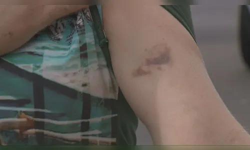 Motociclista invade calçada, arranca bolsa de mulher e foge