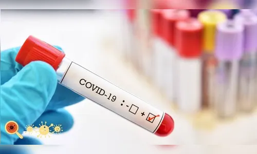 Paraná confirma neste sábado (13) mais 3.136 casos de Covid-19