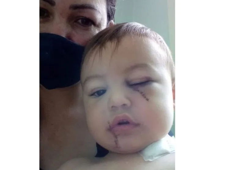 Criança ferida em atentado a creche deixa UTI