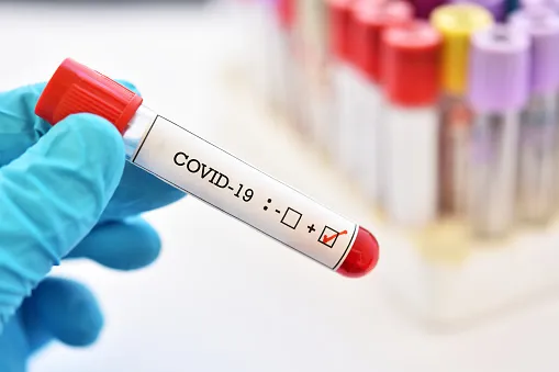 Jandaia do Sul soma mais 12 casos de Covid-19