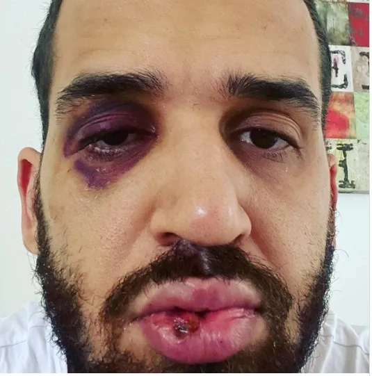 Médico do Paraná é agredido após defender lockdown
