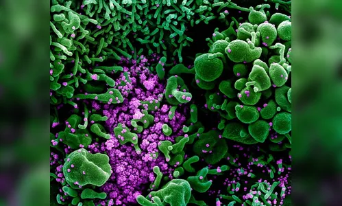 10 pessoas morrem por Covid-19 em Londrina