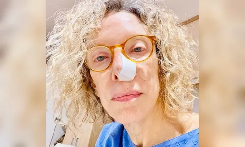 Aos 72 anos, Marília Gabriela revela câncer de pele