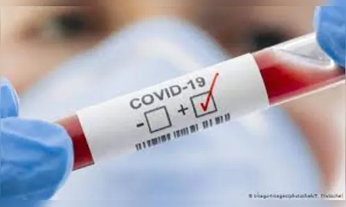 Apucarana chega a 200 óbitos por Covid-19