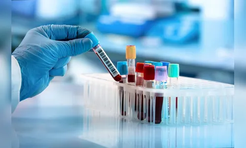 Apucarana confirma 3 novos óbitos e mais 47 casos de Covid