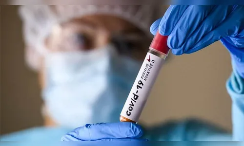 Arapongas registra 64 novos casos e 3 óbitos por Covid