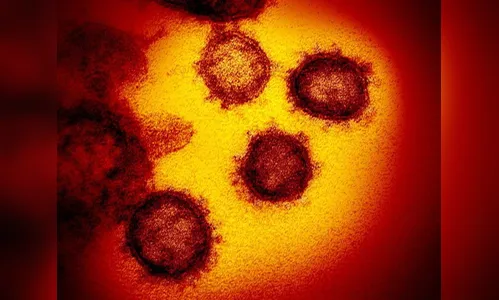 Arapongas registra 67 novos casos de Covid-19 e dois óbitos