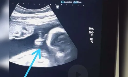 Bebê faz “V” da vitória e emociona pai com câncer