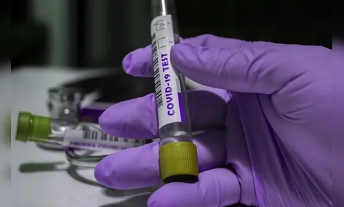 Brasil tem novo recorde diário, com 3.780 mortes por covid