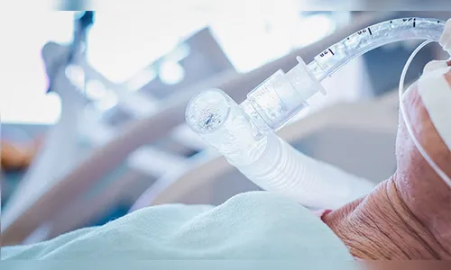 Covid-19: Apucarana cede oxigênio para cidade da região