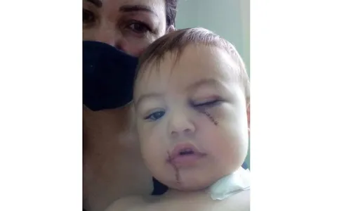 Criança ferida em atentado a creche deixa UTI