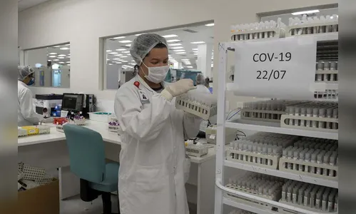 Boletim: Mais quatro casos positivos de  Covid-19  em Jardim Alegre