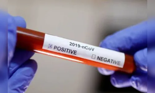 Covid-19: 16 novos casos e 36ª morte confirmada em Ivaiporã