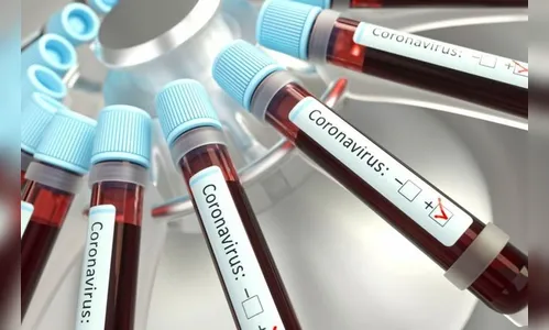 Saúde registra 17 novos casos de Covid em Ivaiporã