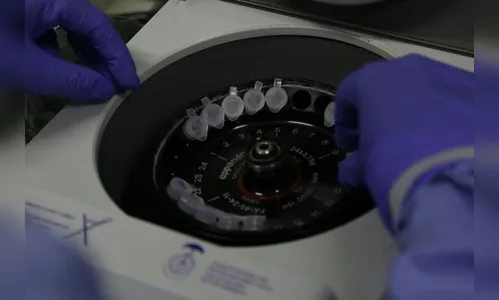 Ivaiporã registra sete diagnósticos de Covid-19 e queda nos casos ativos