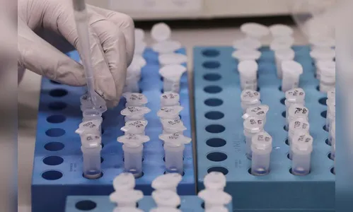 Mais seis casos de Covid-19 confirmados em Ivaiporã