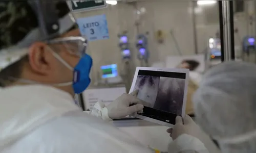 Ivaiporã tem 96,2% de ocupação em UTI adulto para Covid-19