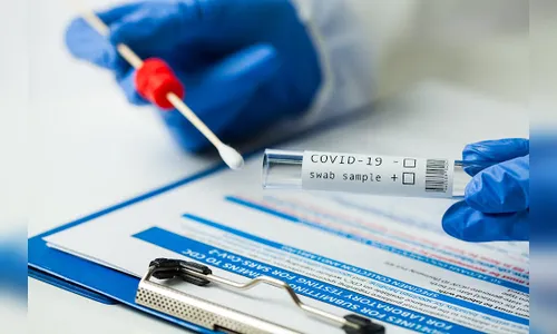 Ivaiporã confirma 16 novos casos de coronavírus